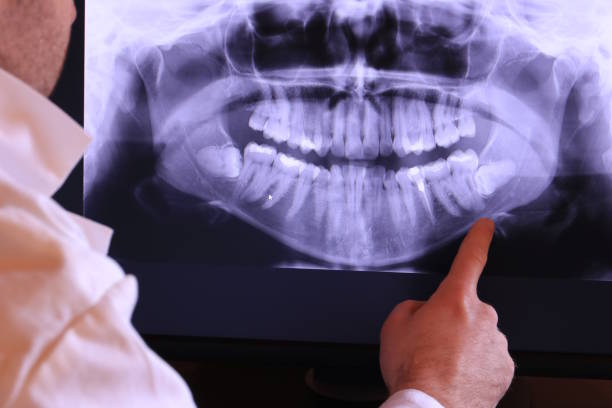 Best Emergency Dental Care for Broken or Chipped Teeth in Pottstown, PA