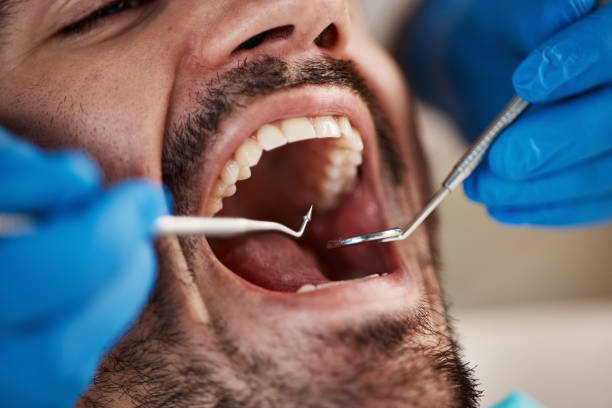 Best Emergency Treatment for Dental Infections or Abscesses in Pottstown, PA